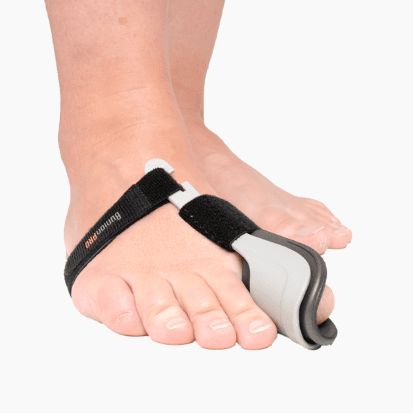 Bunion correction - BunionPro