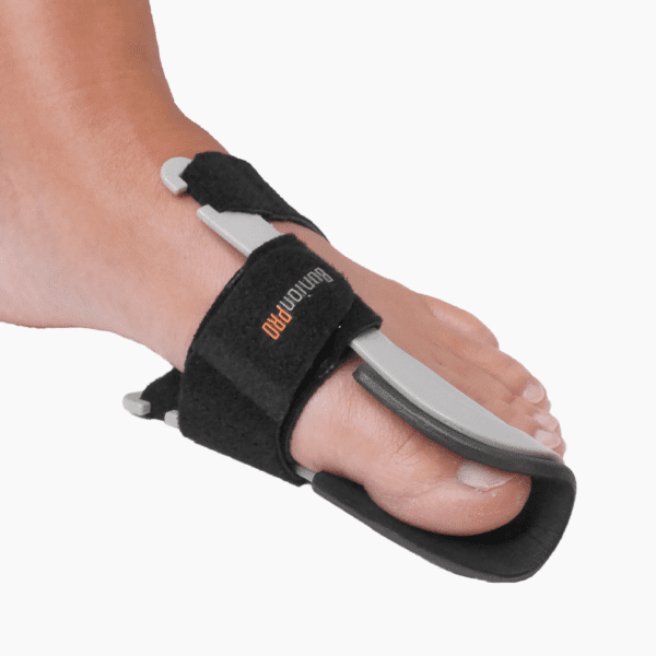 Bunion correction - BunionPro